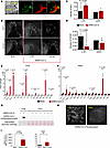 Macrophage remodeling in the CCS.