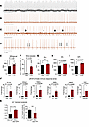The dsRNA mimetic PIC induces cardiac arrhythmias and innate immune respons
