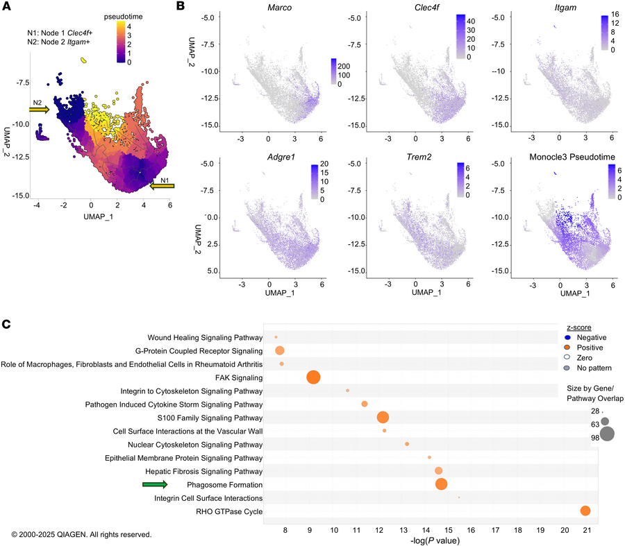 Pseudotime analysis of macrophage phenotypic plasticity in chronic CCl4-...