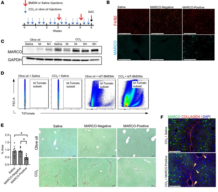 Adoptive transfer of MARCO+ BMDMs reduces fibrosis in vivo.
(A) Schemati...