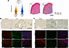 MARCO+ macrophages are increased in chronic liver fibrosis but localize to