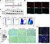 Adoptive transfer of MARCO+ BMDMs reduces fibrosis in vivo.