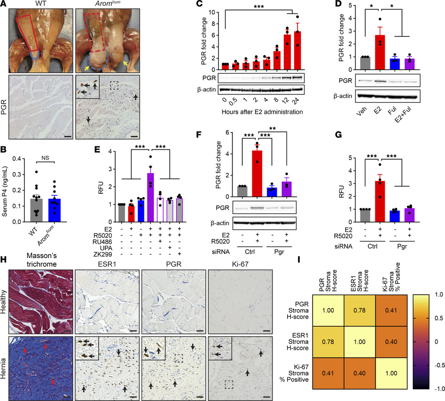 Effect of E2/ESR1-induced PGR expression on LAM fibroblast proliferation...
