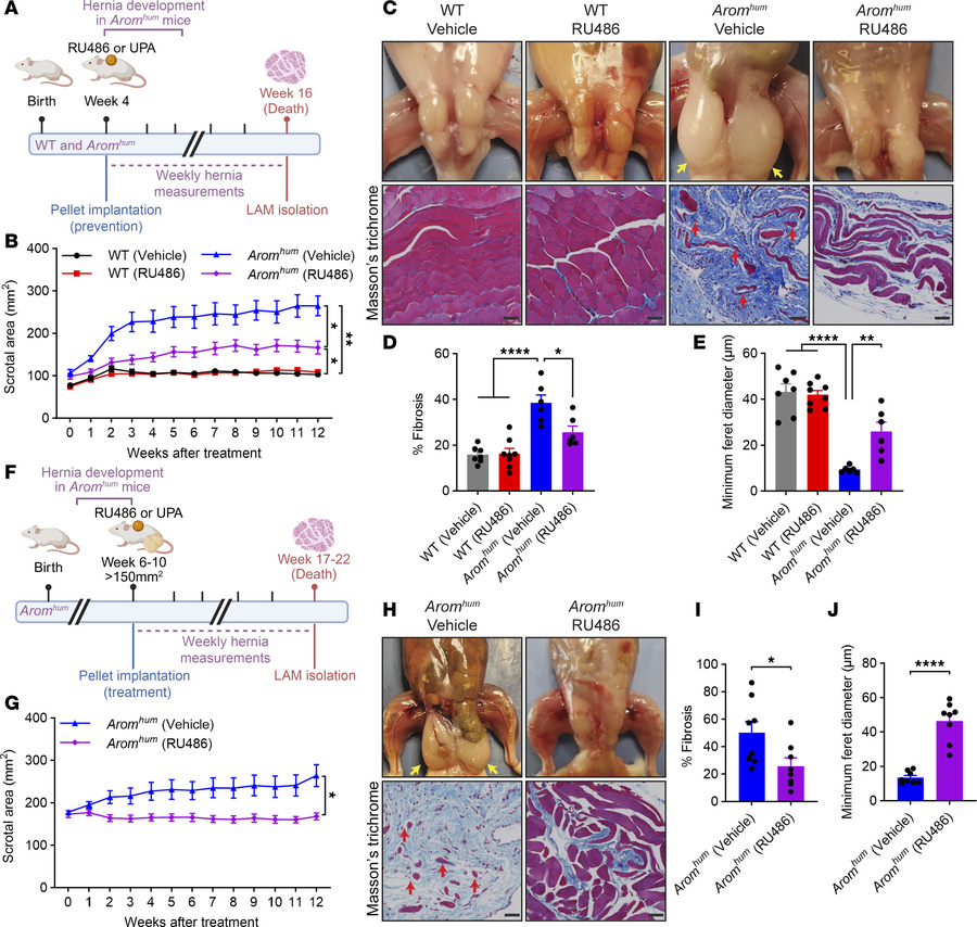Treatment with progesterone antagonist RU486 prevents hernia development...