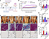 RU486 treatment prevents exogenous E2/P4-induced hernia development in WT m