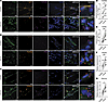 Increased expression of TGF-β pathway–related genes and myofiber atrophy–as