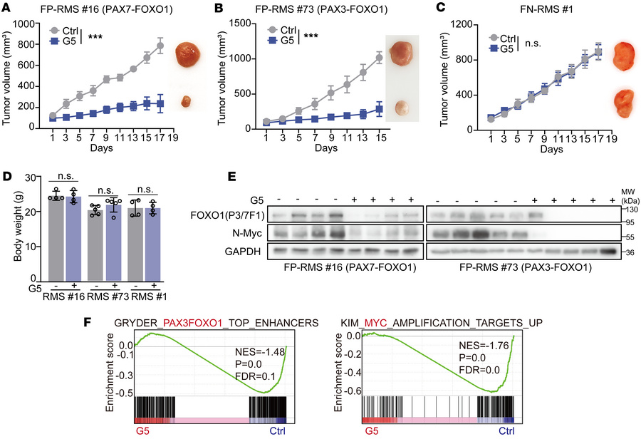 YOD1 inhibitor G5 inhibits FP-RMS tumor growth in vivo.
(A–C) The in viv...