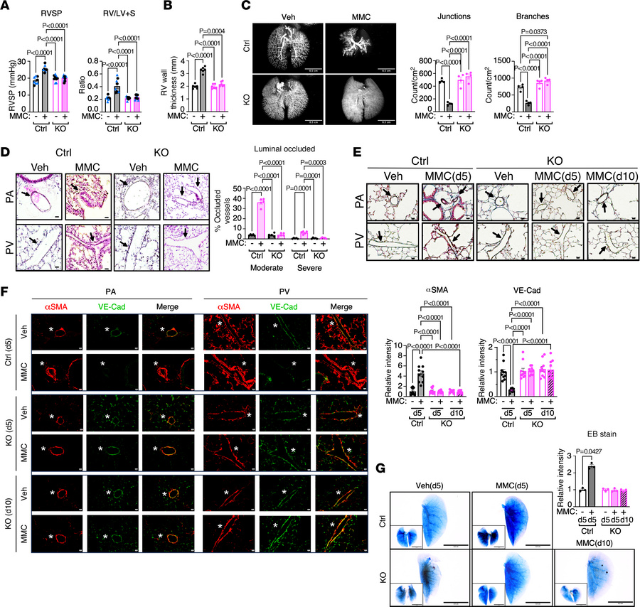 PKR-deficient mice do not develop PVOD phenotypes.
(A) RVSP (mmHg) and R...