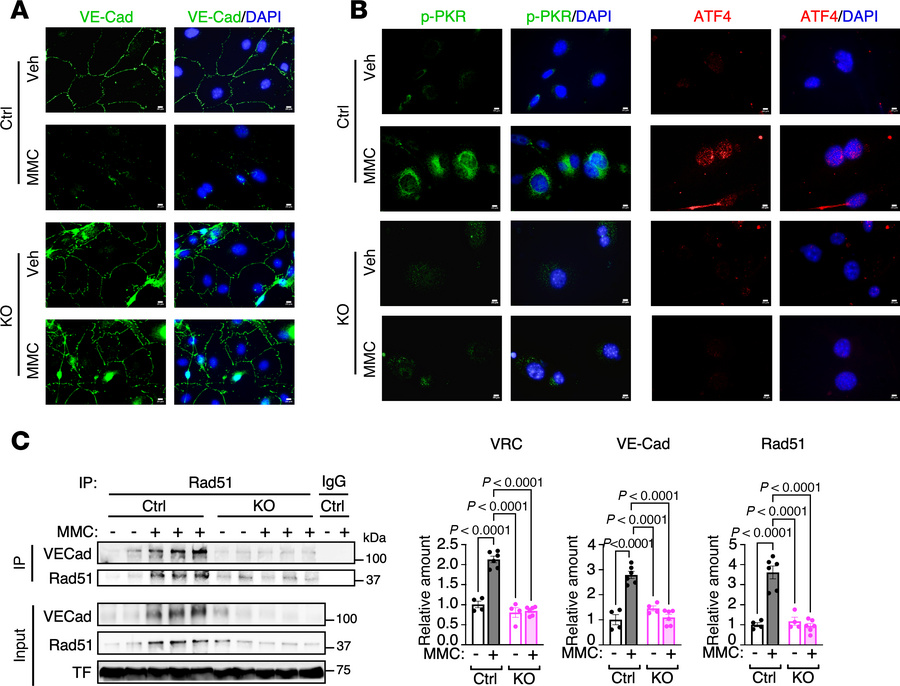MMC treatment does not impair pulmonary vascular endothelium in PKR-defi...