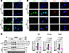 MMC treatment does not impair pulmonary vascular endothelium in PKR-deficie