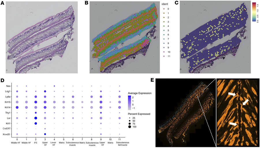 Spatial transcriptomic analysis of the dorsal skin of Krox20-CreERT; R26...