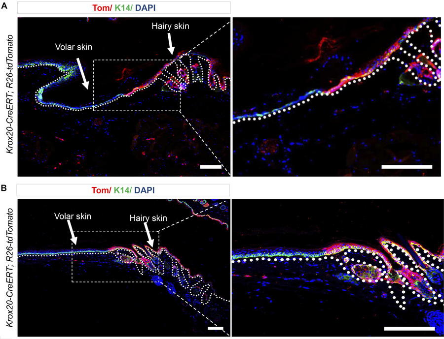 
Krox20 is not expressed in the volar epithelium.
(A and B) Lineage trac...