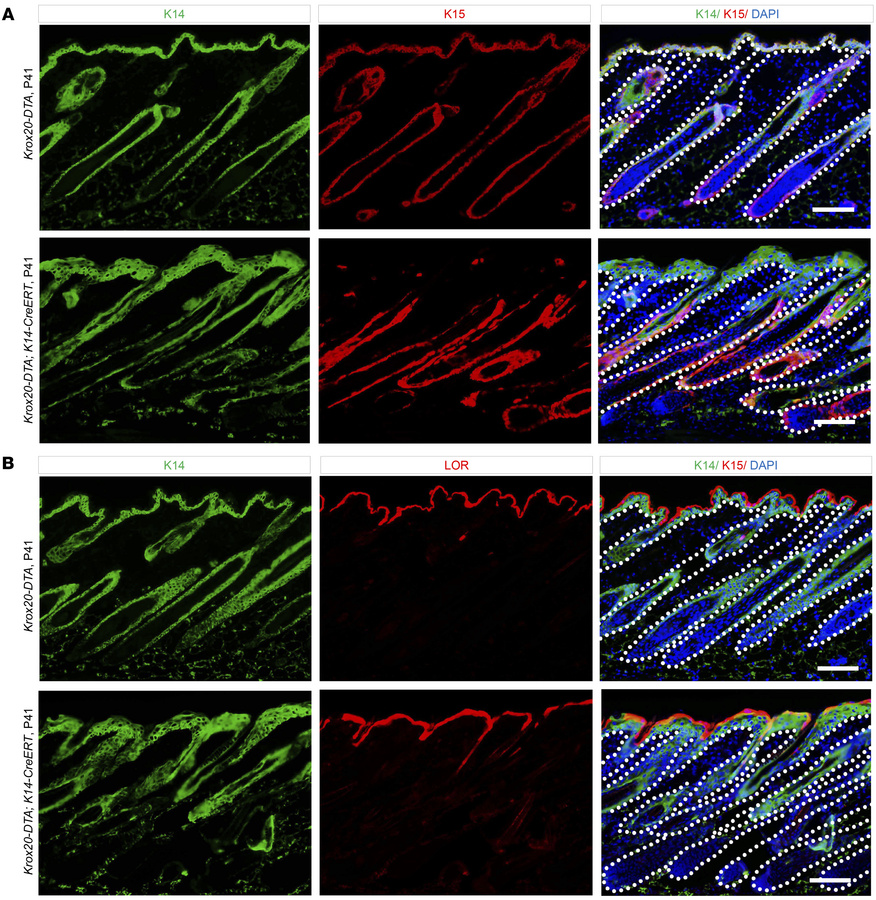 
Krox20+ cells are indispensable for skin homeostasis.
(A and B) Analysi...
