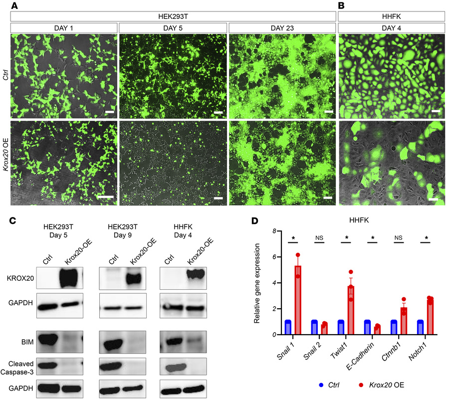 
Krox20 overexpression in vitro alters cell identity.
Overexpression of ...