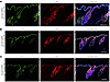 Krox20-lineage cells overlap with IFE markers.
