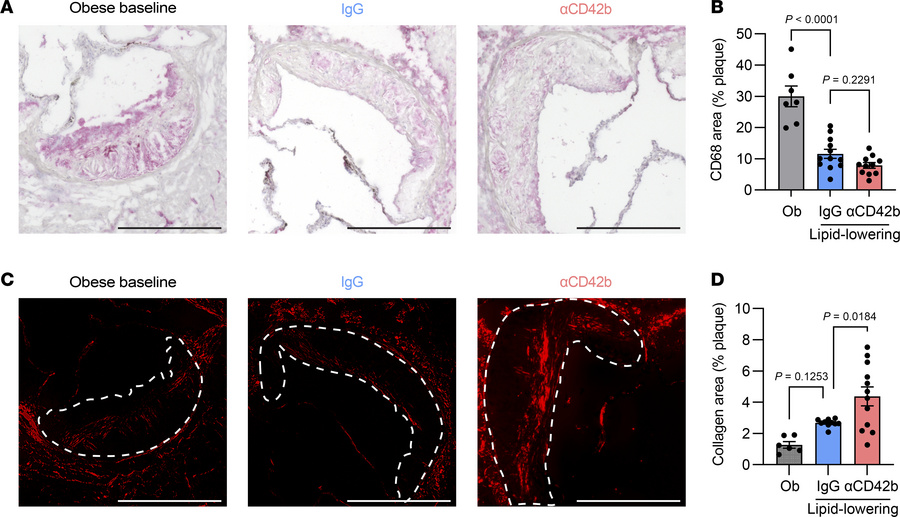 Platelet deficiency alters plaque composition after lipid lowering.
(A) ...
