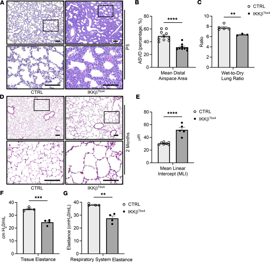 NF-κB activation in the lung mesenchyme alters saccular-stage lung devel...