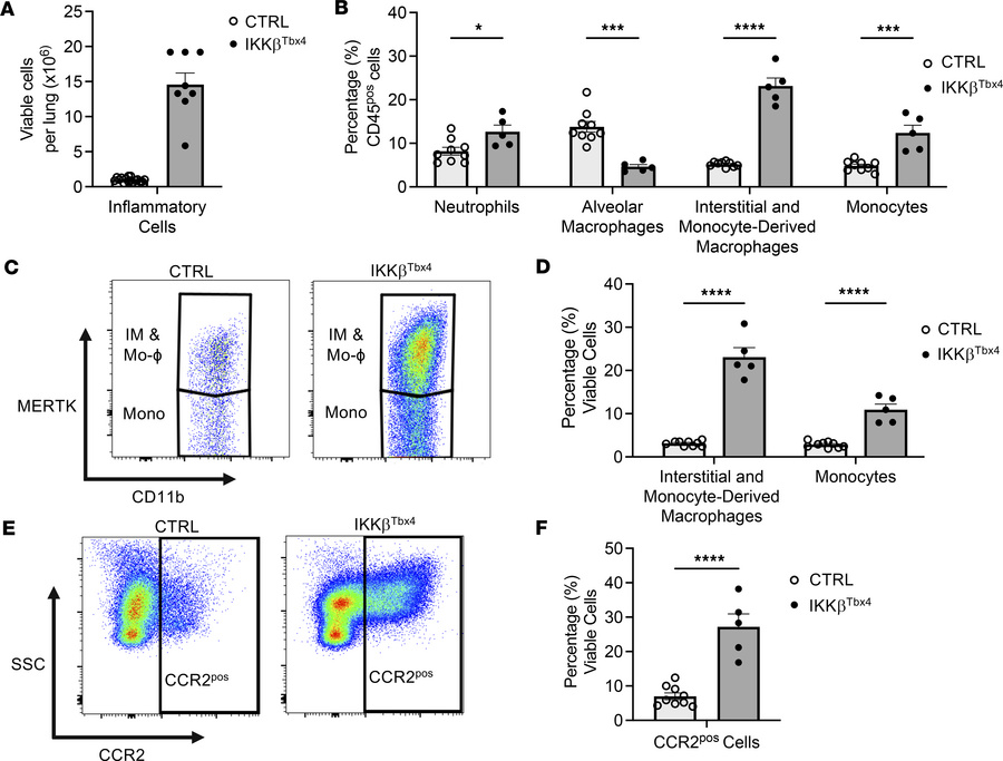 Mesenchymal-derived inflammation recruits macrophages to the saccular-st...