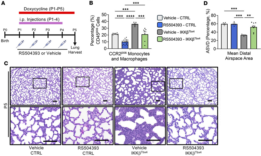 Inhibiting recruitment of CCR2pos monocyte-derived macrophages rescues s...