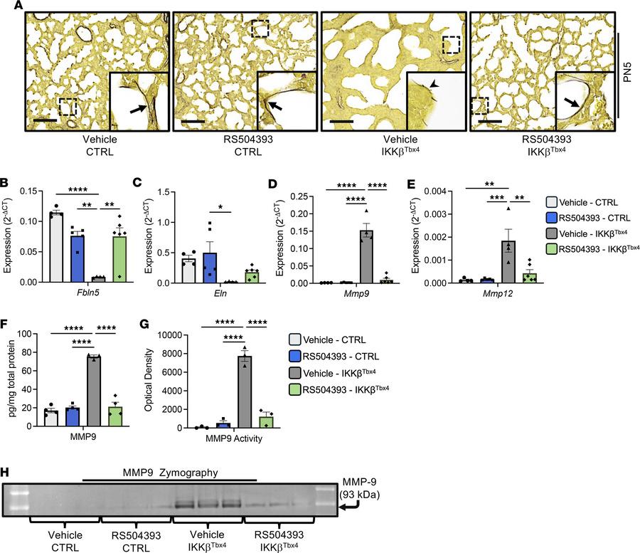Elastic fiber organization is altered in IKKβTbx4 lungs and rescued with...