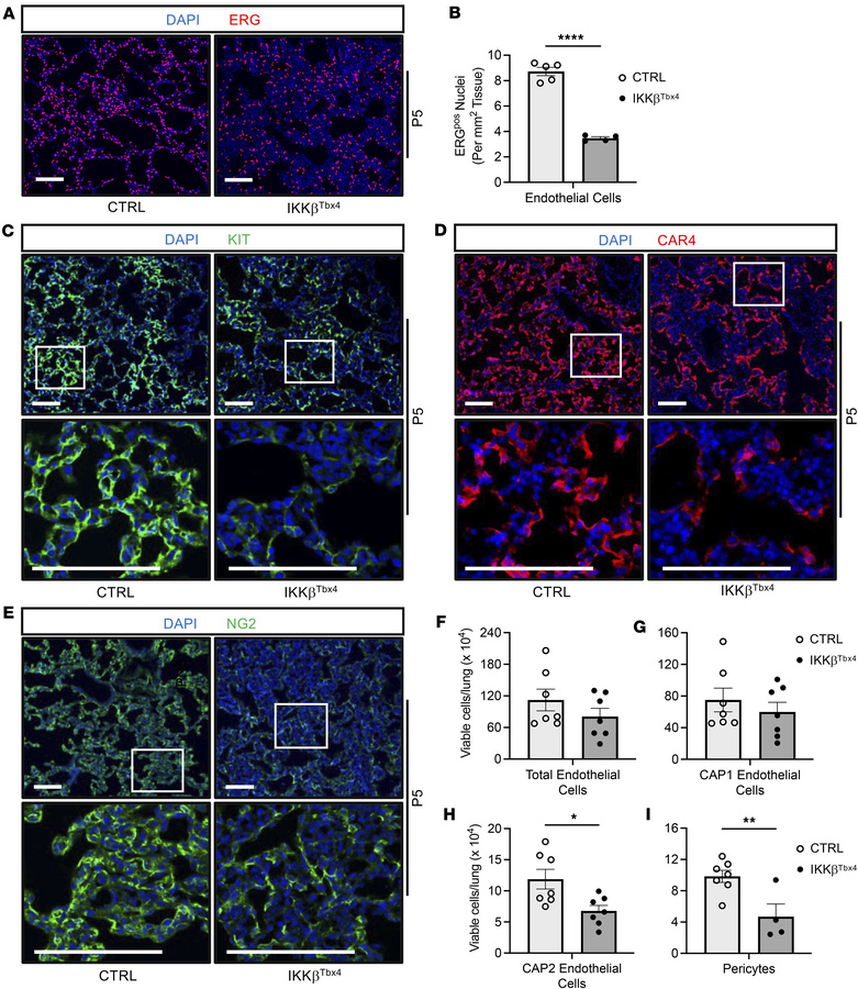 CAP2 endothelial cells and pericytes are reduced in IKKβTbx4 lungs.
Doxy...