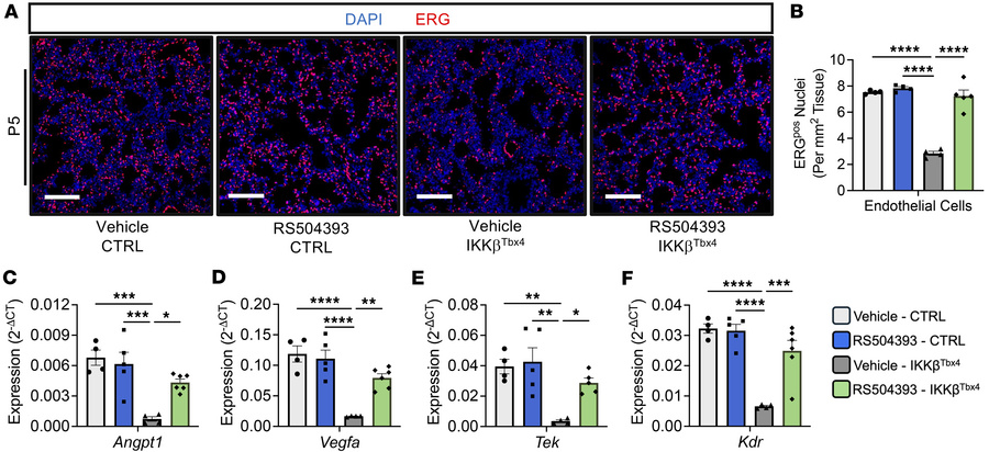 CCR2 antagonism rescues vascular development in IKKβTbx4 mice.
Doxycycli...