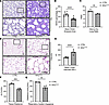 NF-κB activation in the lung mesenchyme alters saccular-stage lung developm