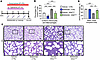 Inhibiting recruitment of CCR2pos monocyte-derived macrophages rescues stru