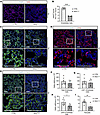 CAP2 endothelial cells and pericytes are reduced in IKKβTbx4 lungs.
