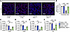 CCR2 antagonism rescues vascular development in IKKβTbx4 mice.