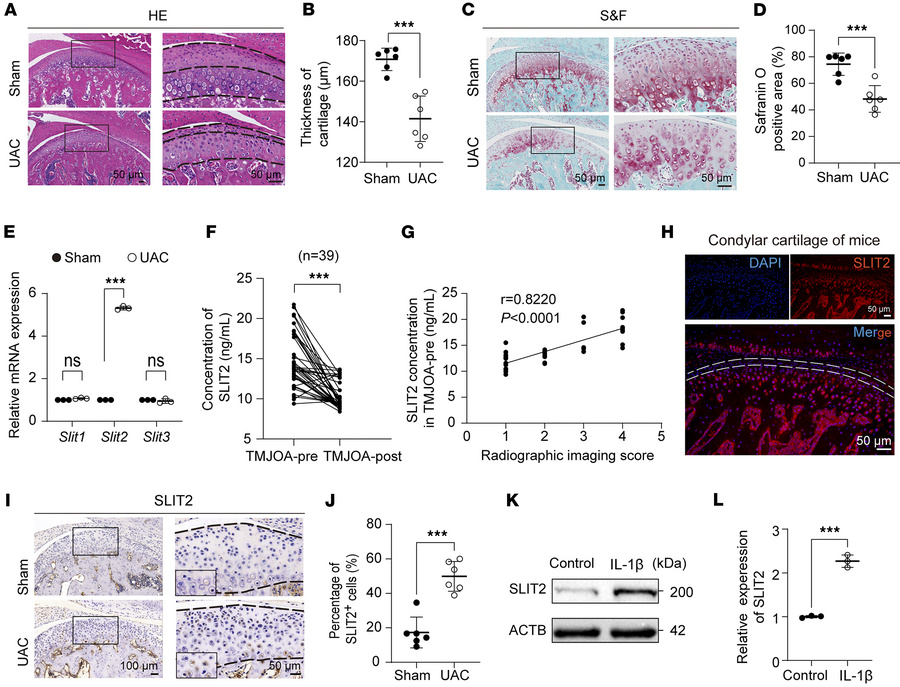 Upregulation of SLIT2 expression in joint tissues in OA.
(A and B) Histo...