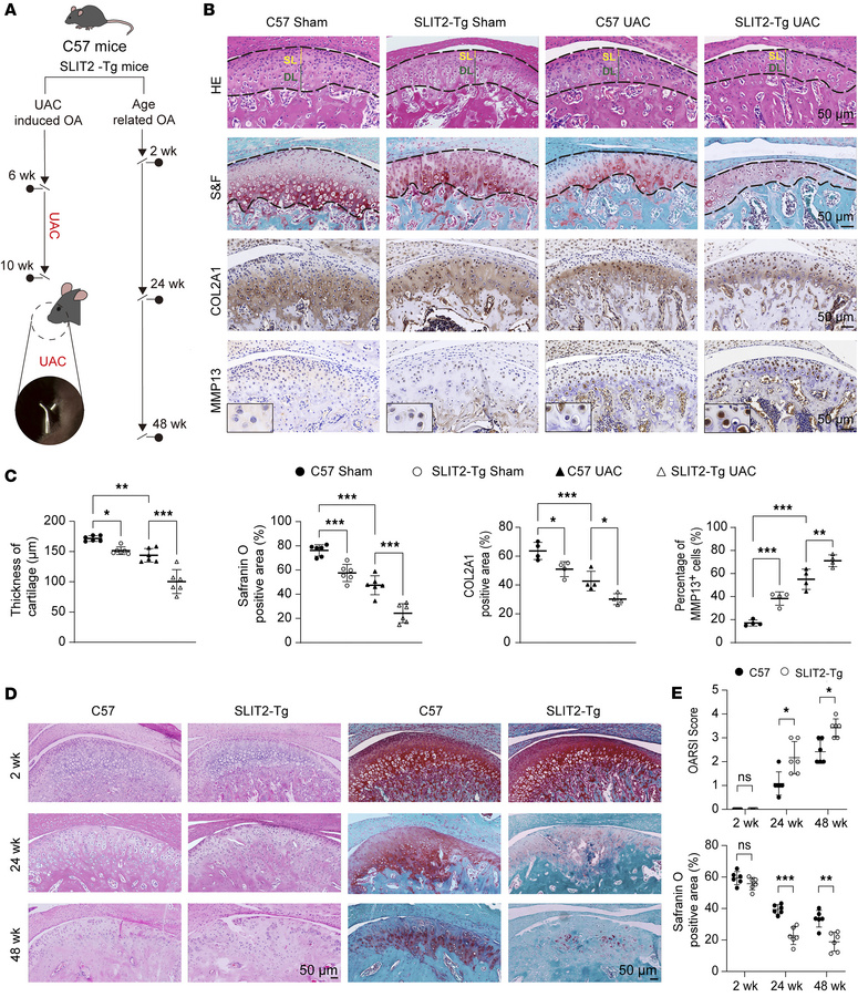 SLIT2 overexpression aggravated cartilage degradation in UAC-induced and...