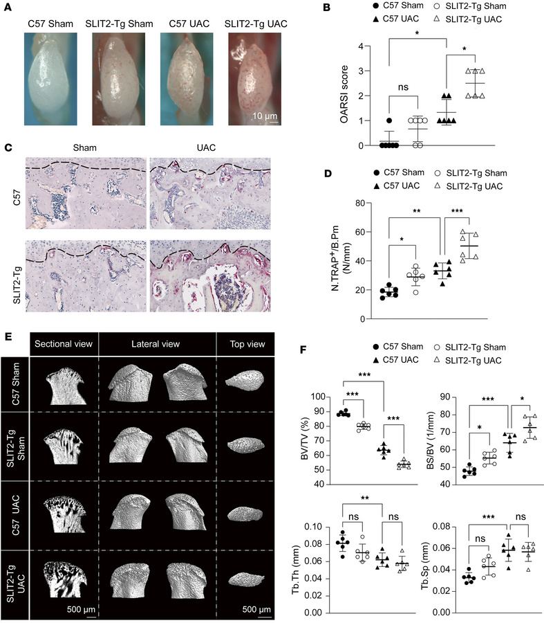 SLIT2 overexpression exacerbated subchondral bone loss in UAC-induced TM...