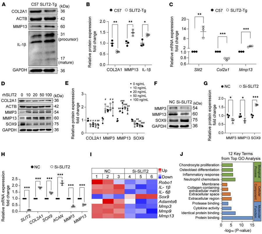 SLIT2 led to an inflammatory response and catabolism in chondrocytes.
(A...
