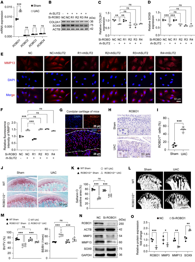 Knocking down ROBO1 alleviated cartilage degradation in TMJOA.
(A) Robo ...