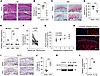 Upregulation of SLIT2 expression in joint tissues in OA.