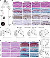 SLIT2 overexpression aggravated cartilage degradation in UAC-induced and ag