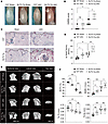 SLIT2 overexpression exacerbated subchondral bone loss in UAC-induced TMJOA