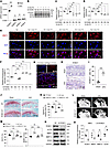 Knocking down ROBO1 alleviated cartilage degradation in TMJOA.