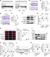 SLIT2/ROBO1 signaling–induced cartilage degradation is regulated by LRP6-me