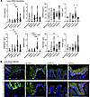 Heat shock intermediates and IL-33 expression in airway disease tissue.