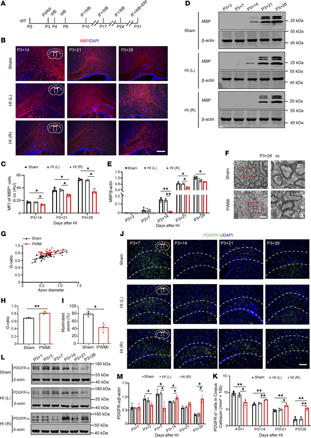 Myelination deficits in PWMI model mice.
(A) Experimental diagram. (B an...