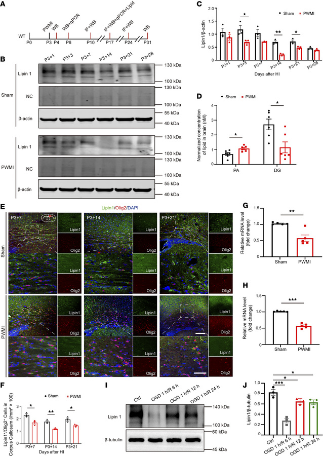 Reduced expression of Lipin1 in the OPCs of PWMI mice.
(A) Experimental ...