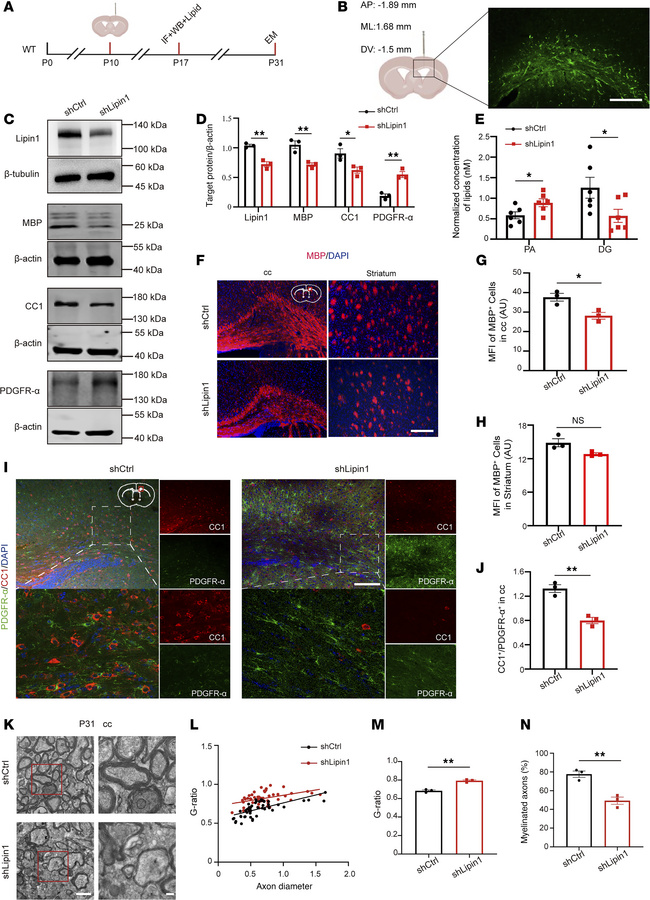Reduced Lipin1 expression in the corpus callosum impairs OPC differentia...