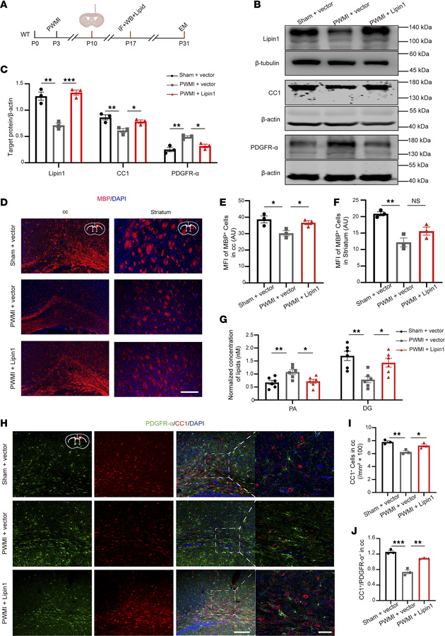 Overexpression of Lipin1 in the corpus callosum promotes OPC differentia...
