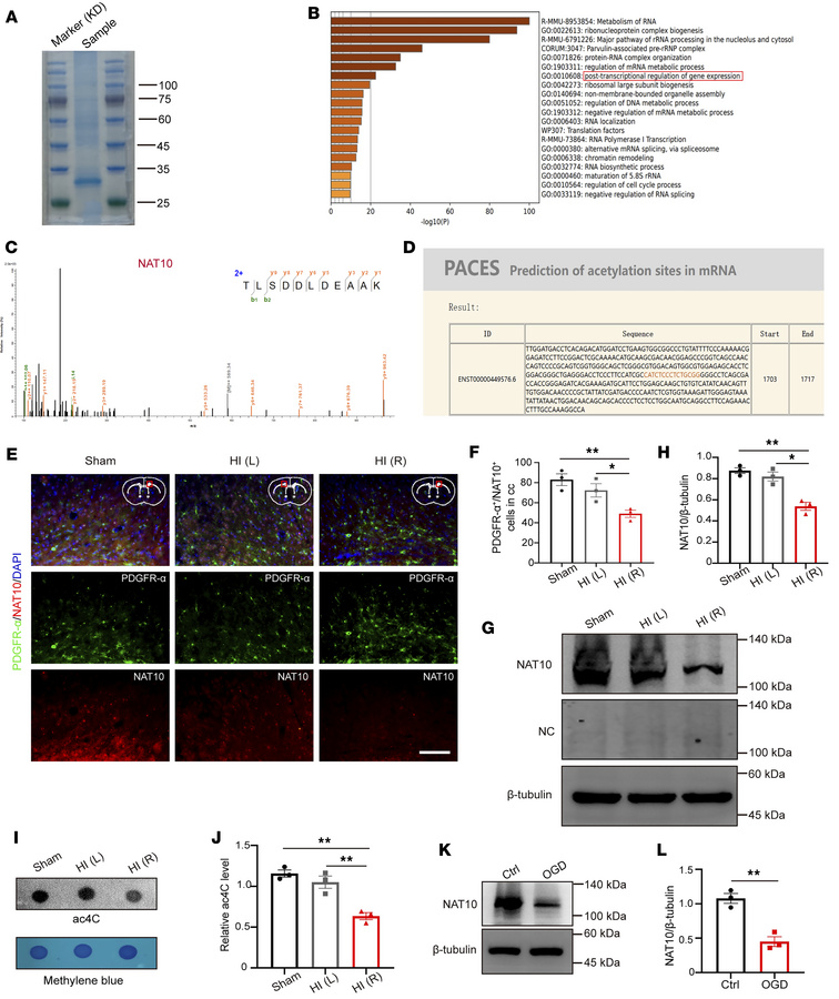Reduced NAT10 expression in OPCs of PWMI mice.
(A) Mass spectrometry res...