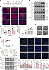 Myelination deficits in PWMI model mice.