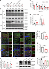 Reduced expression of Lipin1 in the OPCs of PWMI mice.