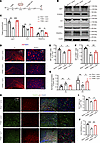 Overexpression of Lipin1 in the corpus callosum promotes OPC differentiatio