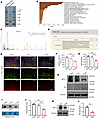 Reduced NAT10 expression in OPCs of PWMI mice.